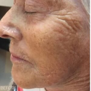 0c57df496_bt-sculpt-Handheld-Microcurrent-Facial-Sculpting-System-Bio-Therapeutic-2.jpg bt-sculpt – Microcurrent Facial Sculpting System | Bio-Therapeutic