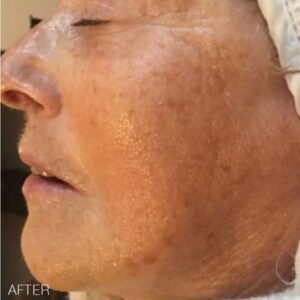 562705f73_bt-sculpt-Handheld-Microcurrent-Facial-Sculpting-System-Bio-Therapeutic-3.jpg bt-sculpt – Microcurrent Facial Sculpting System | Bio-Therapeutic