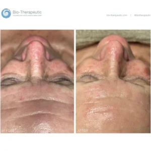 BT-BEFOREANDAFTER-ALL-WEB-REV06252524_bbb2dfc1-6cf5-480a-9e34-f57ecd059d40 bt-sculpt GEN2 | Microcurrent Facial Sculpting System | Bio-Therapeutic
