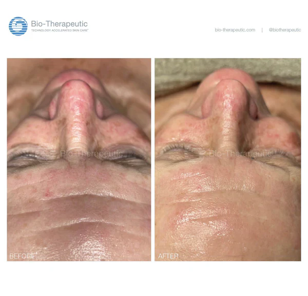 bt-sculpt GEN2 | Microcurrent Facial Sculpting System | Bio-Therapeutic - Image 10