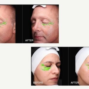 imgi_28_BTF2-0102025-BTSCULPTGEN2-BTF bt-sculpt GEN2 | Microcurrent Facial Sculpting System | Bio-Therapeutic
